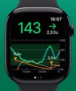 Apple Watch連携のやり方と注意点