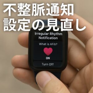 不整脈通知設定の見直し